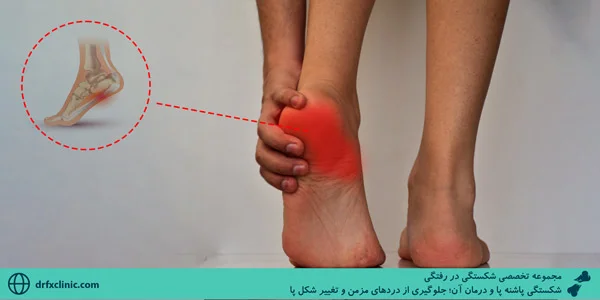 heel-fracture-and-its-treatment%3B-Preventing-chronic-pain-and-changing-the-shape-of-the-foot