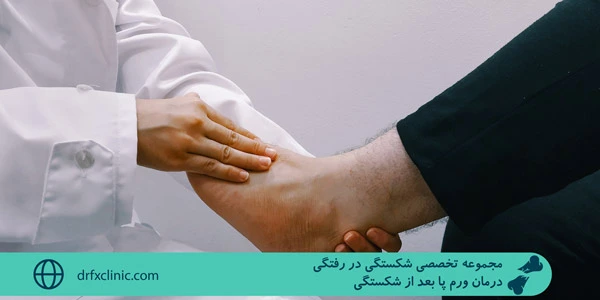 Treatment-of-leg-swelling-after-fracture