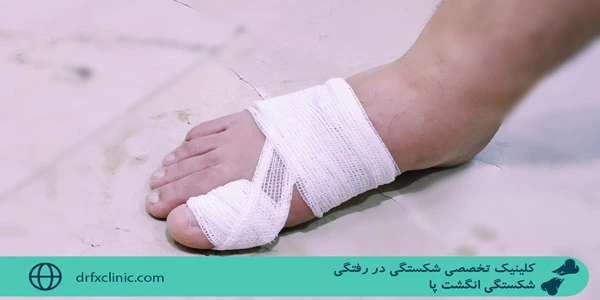 broken-toe