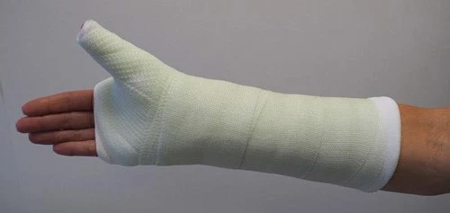Hand-swelling-fracture-surgery