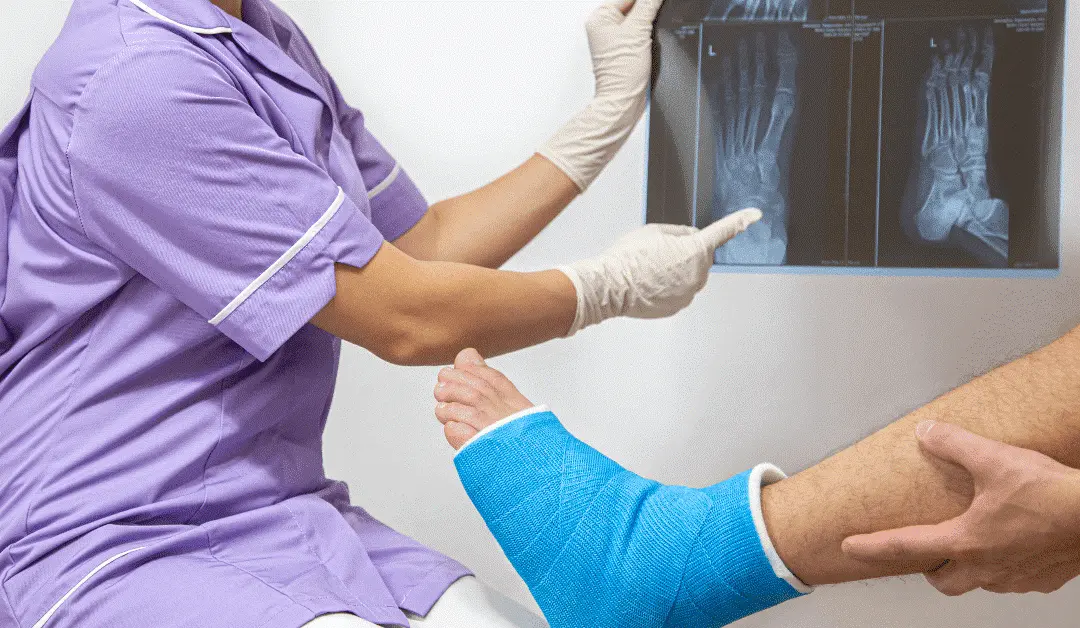 Heel-fracture-healing-time