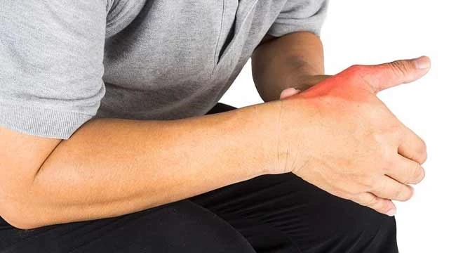Thumb-fracture-symptoms