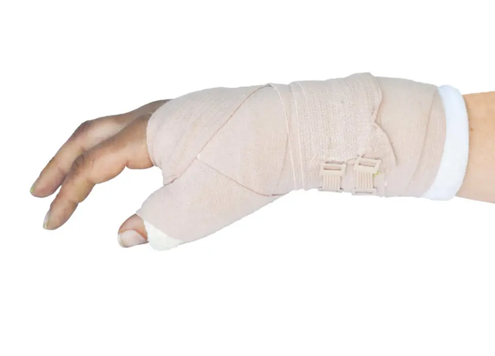 Treatment-hand-fracture