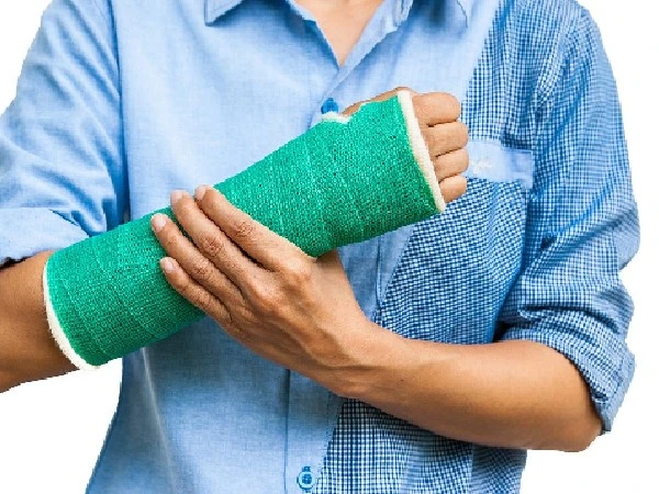 Treatment-swelling-hand-after-fracture