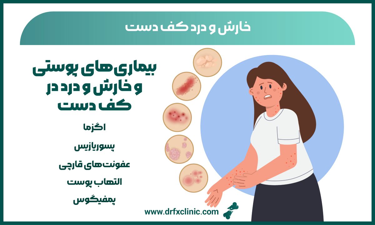 خارش و درد کف دست